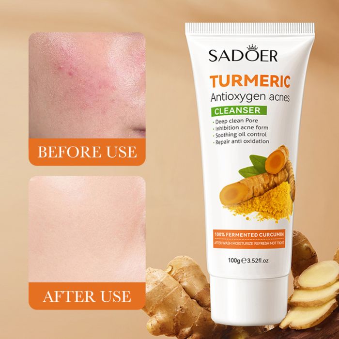 SADOER TURMERIC Antioxidant face foam with turmeric Antioxidant acnes CLEANCER, 100 gr.