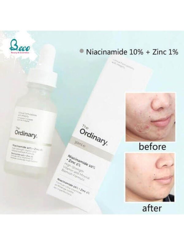 The Ordinary / Serum with Vitamin B3 and Zinc - Niacinamide 10% + Zinc 1%. 30 ml.