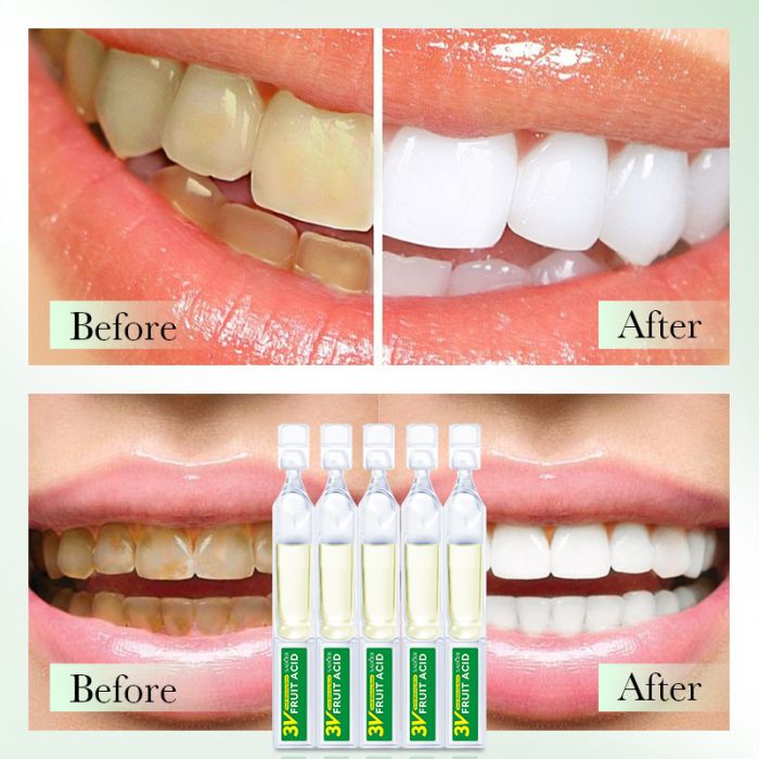 SADOER 3V Fruit Acid Tooth Whitening Serum, 10 pcs*1.5ml